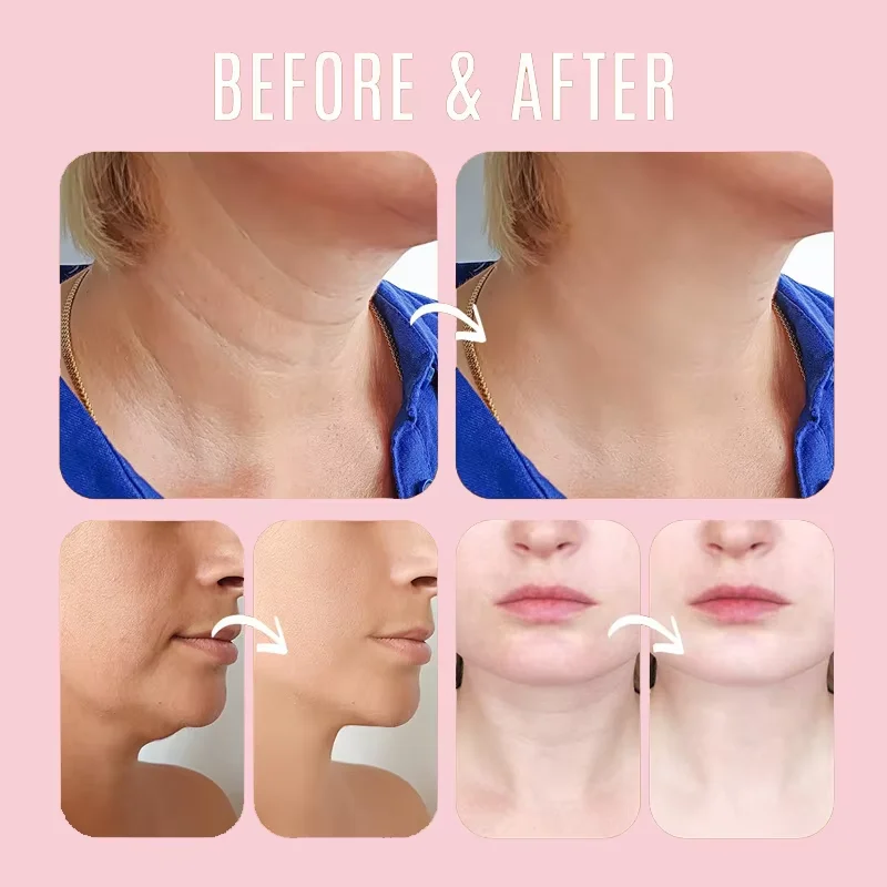 Eliminación de arrugas de colá - Beauty Makeup Cream reseña y precio